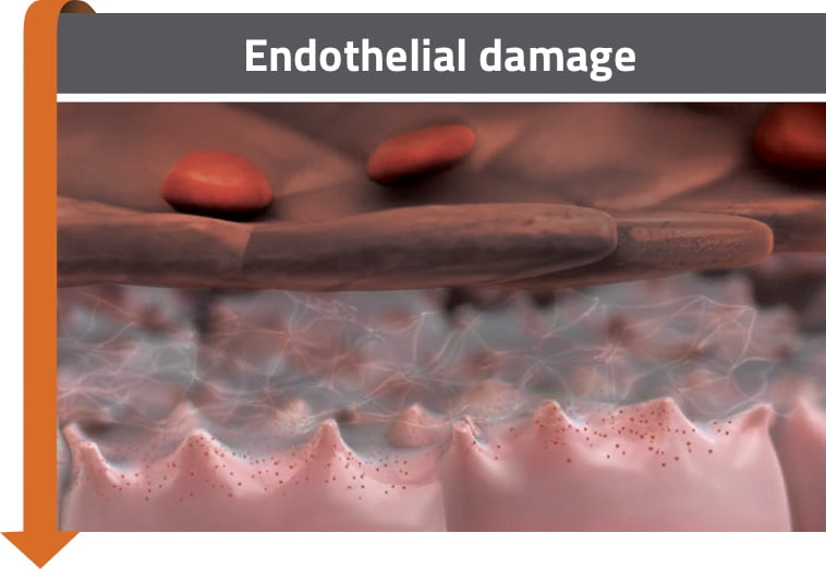 Endothelial cell damage